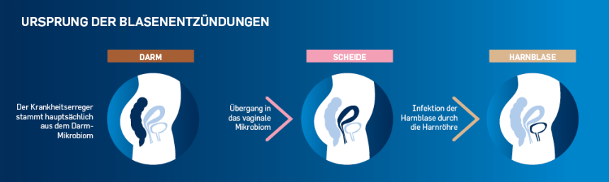 URSPRUNG DER BLASENENTZÜNDUNGEN